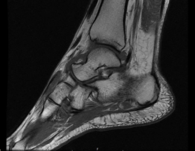 MRI Ankle Case Study 