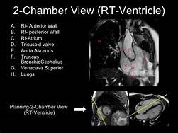 GWIC Will Soon be Offering Cardiac MRI - Greater Waterbury Imaging Center