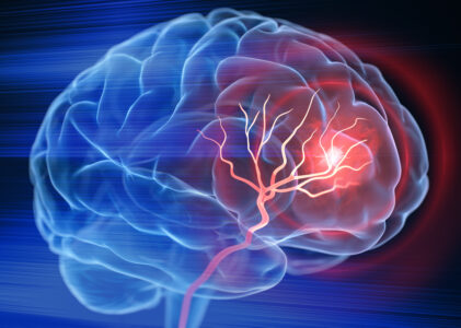 National Stroke Awareness Month: Know the Signs and Act F.A.S.T.
