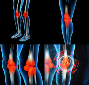 Tibia and Fibula MRI lower extremity