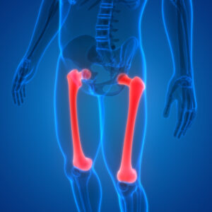 MRI lower extremity Femur bones