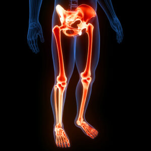 MIR of lower extremity