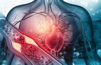 Cardiac MRI 