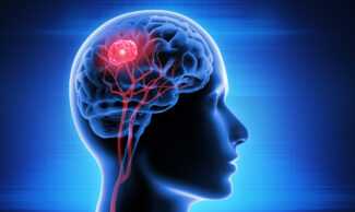 MRI for brain cancer