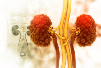 MRI for polycystic kidney disease