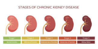 MRI for chronic kidney disease