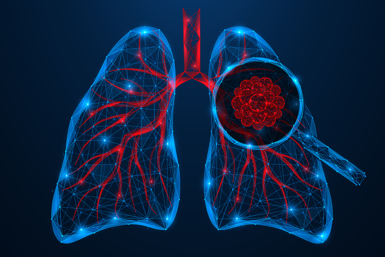 Lung Cancer Awareness Month: Early Detection, Evolving Risks, and the Importance of Screening