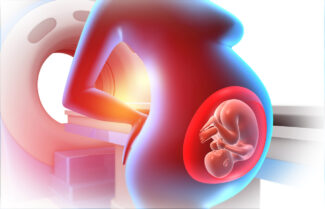 MRI pregnancy