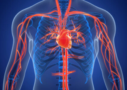Coronary Artery Disease